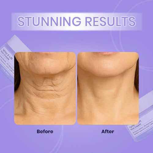 Neck Tightening & Lifting Cream